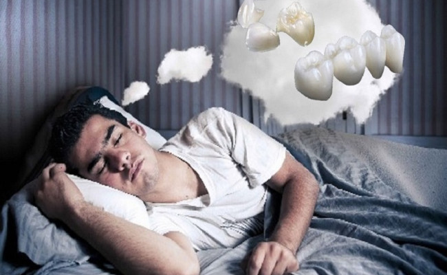 Mơ bị gãy răng là điềm báo gì? Mang ý nghĩa tốt hay xấu?